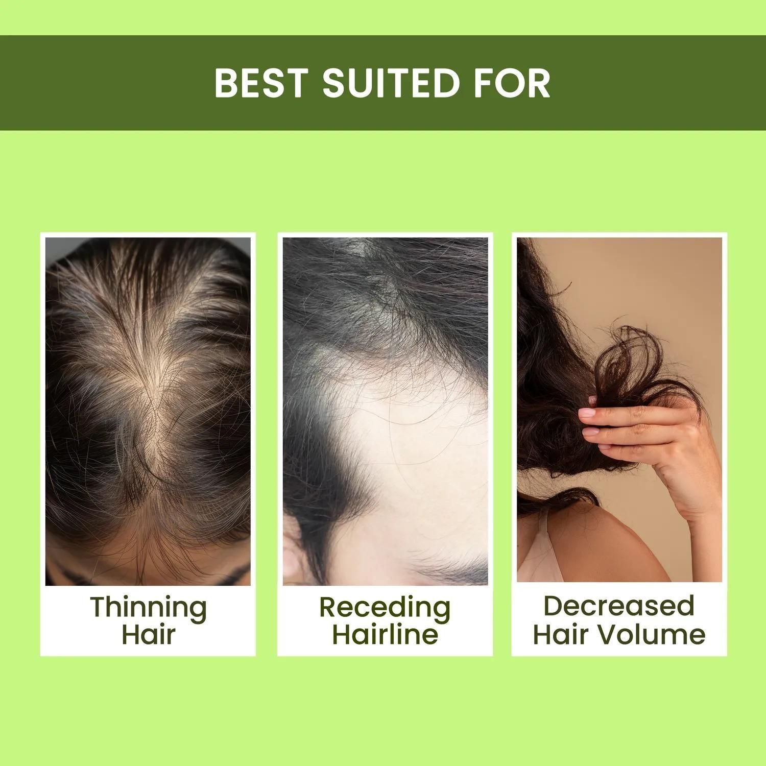 Rosemary Water, Hair Spray For Regrowth Buy 1 Get 2 Free - DEZZIRE